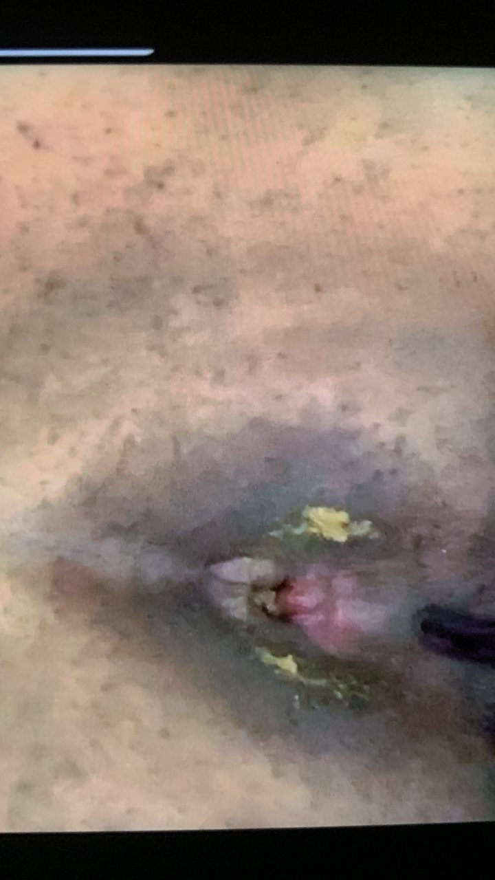 Click to play video Farts - video 155