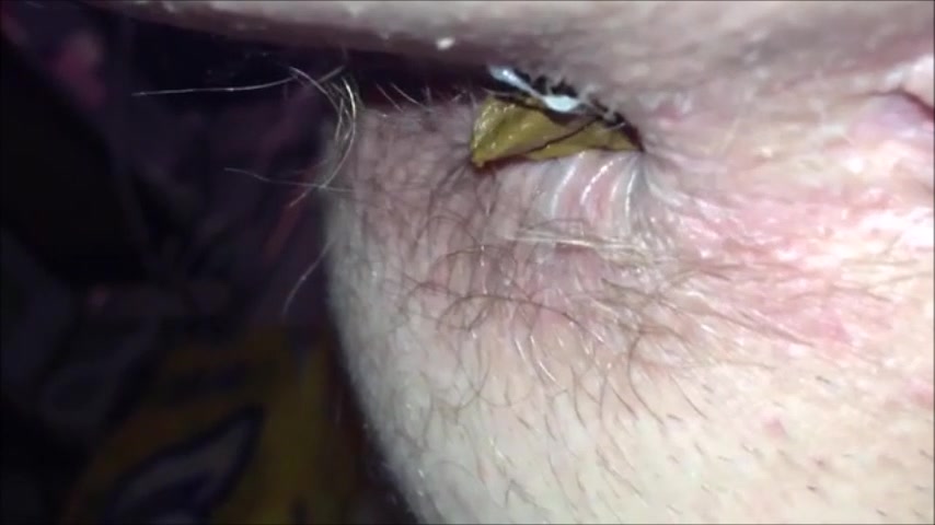 Click to play video Hairy woman shitting close up