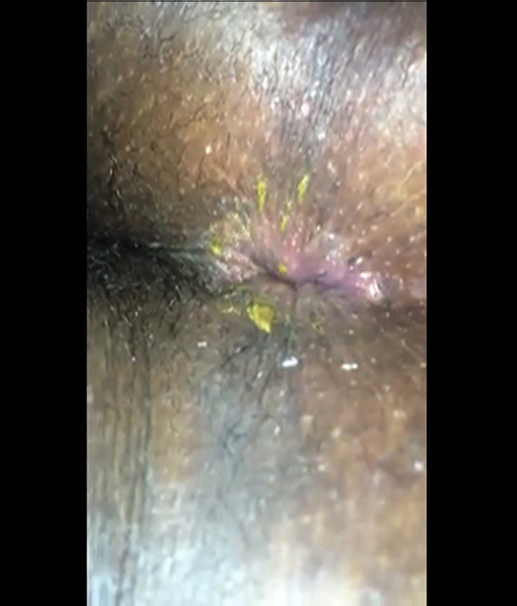Click to play video Sleeoing ebony her shitty asshole