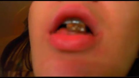Girl Accidentally Swallows Dildo