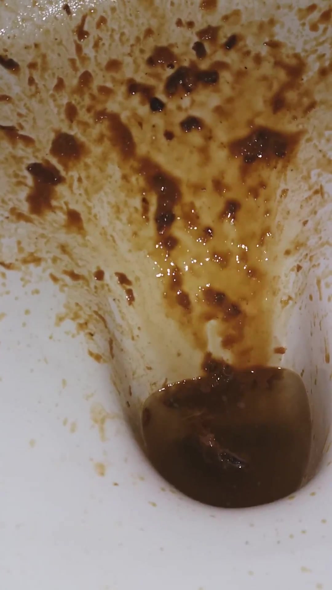 Click to play video Diarrhea - video 67