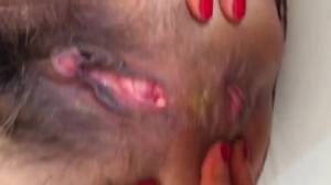 Click to play video netter fick