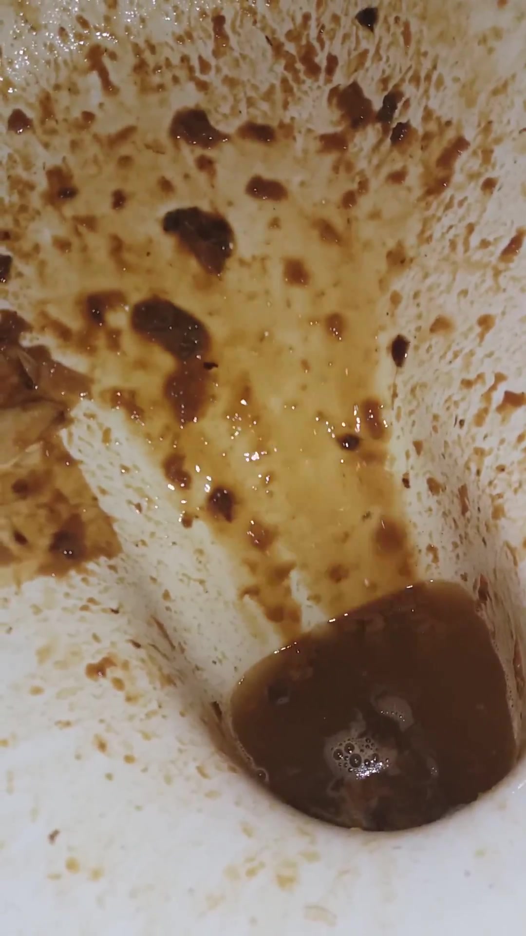 Click to play video Diarrhea - video 66