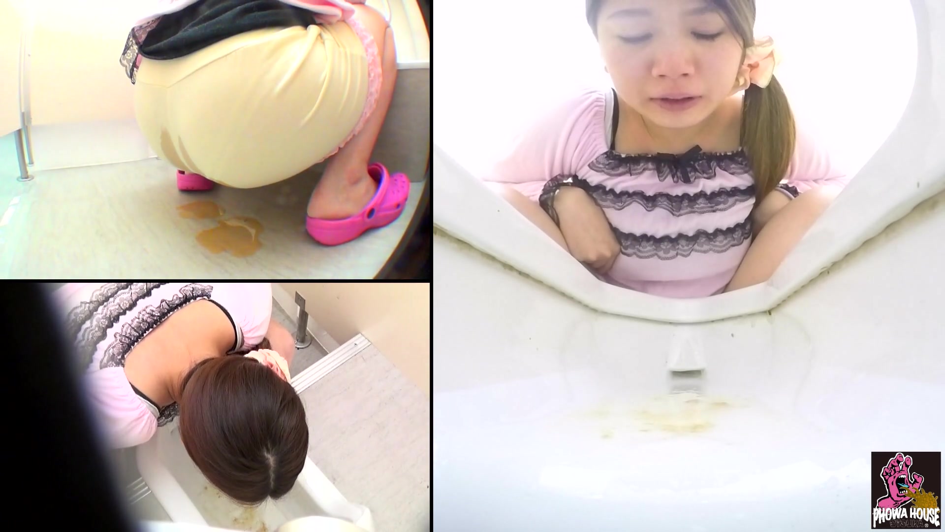 Click to play video Diarrhea and vomiting - part 1