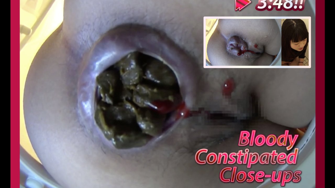 Click to play video Throbbing Constipated Asshole Close - Up