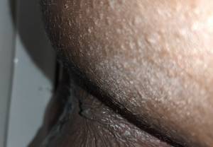 Click to play video Wet Shit Closeup