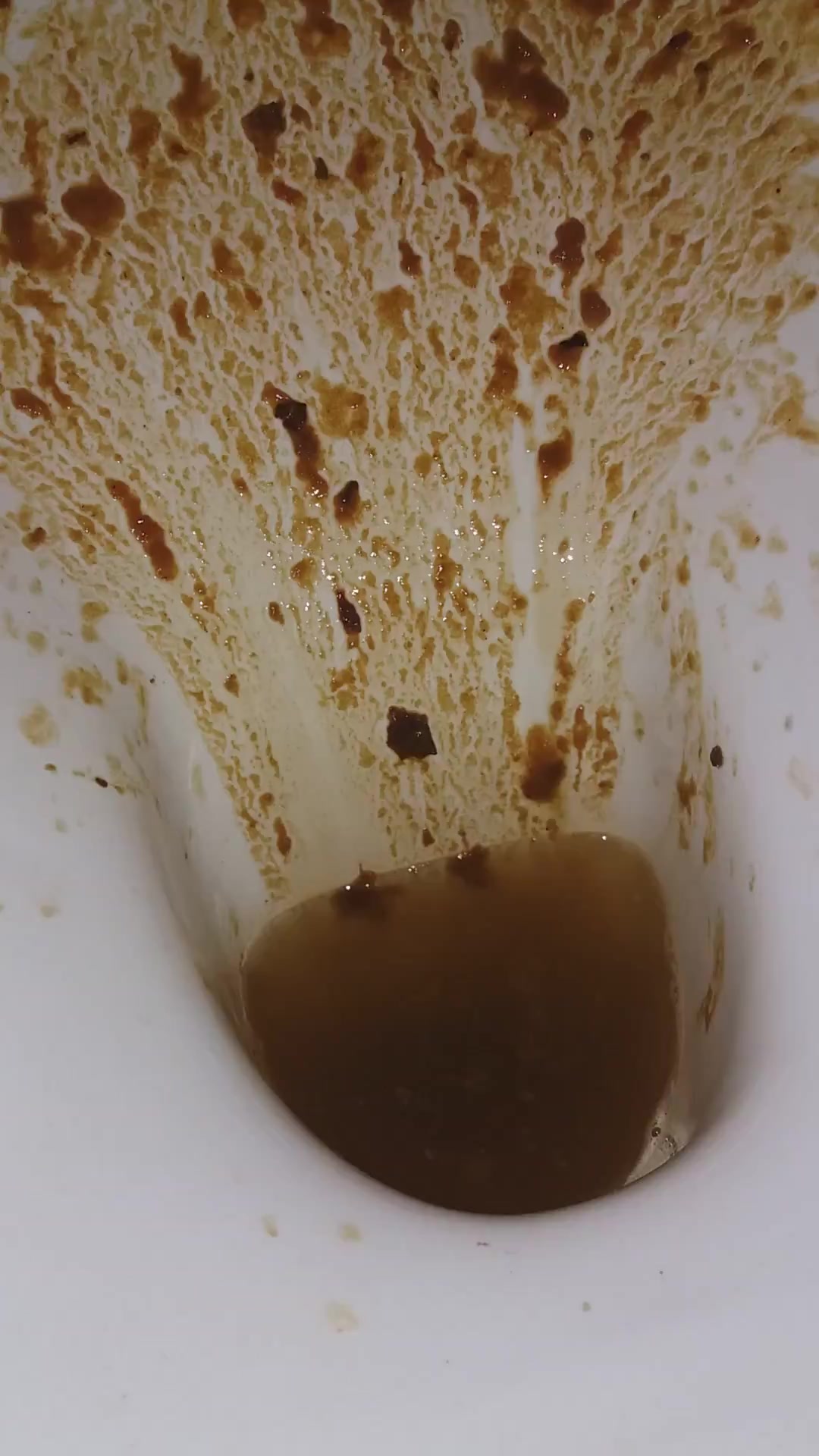 Click to play video Diarrhea - video 64