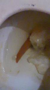 Click to play video I can't believe my poop was that long. 