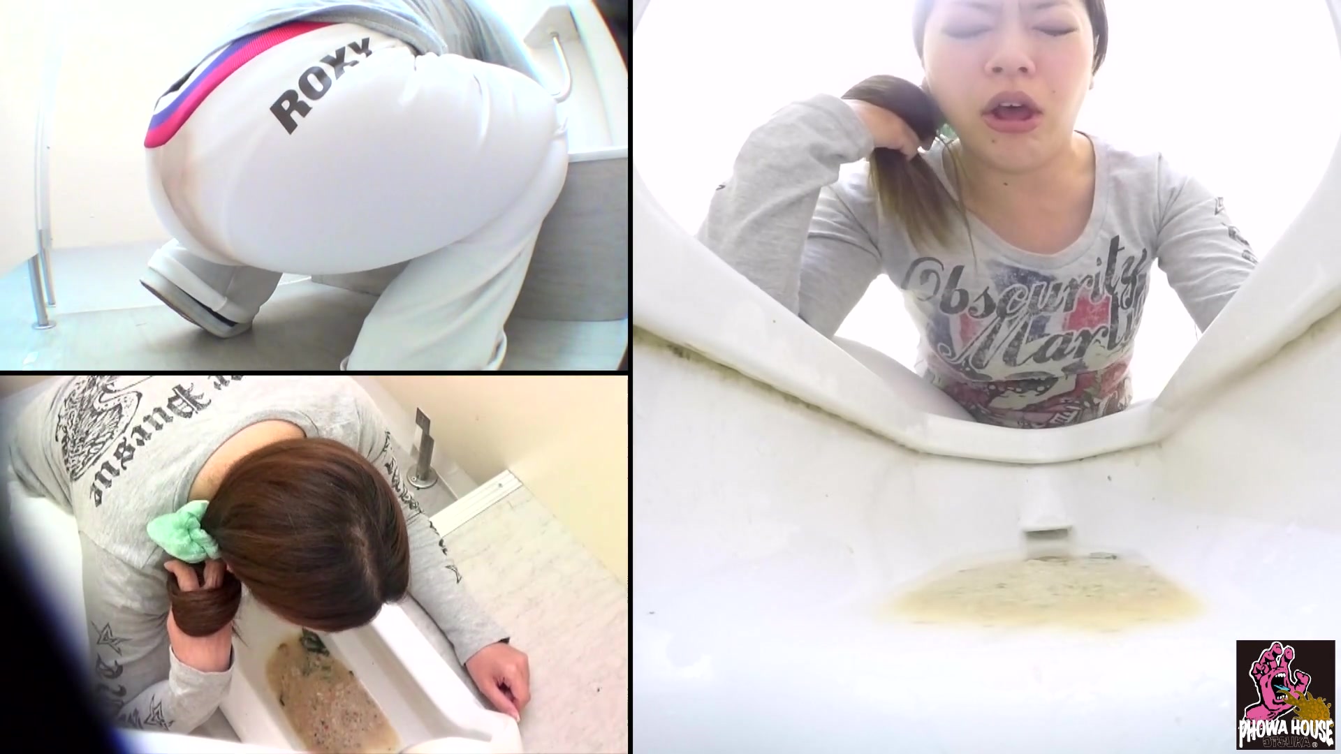Click to play video Diarrhea and vomiting - part 4
