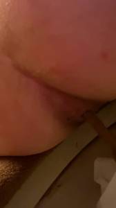 Click to play video Diarrhea at 1/1/2021