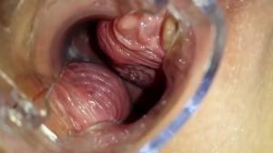 Click to play video Brunette slut overflows her cunt with shit using a speculum
