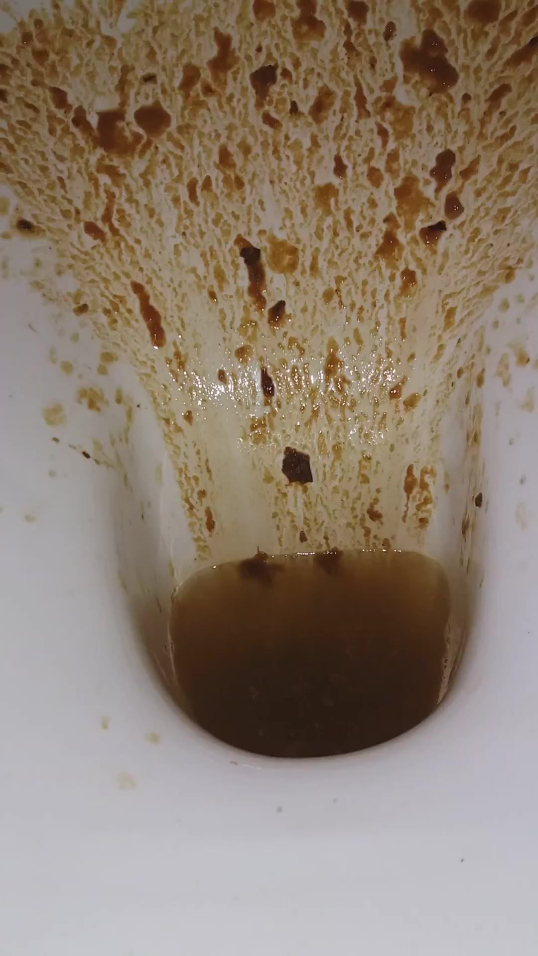 Click to play video Diarrhea - video 63