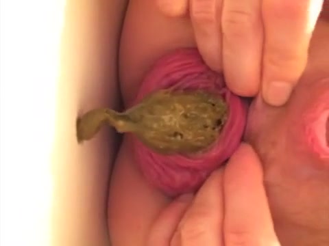 Prolapse Anal Sex Poop - Scat anal prolapse - ScatFap.com - scat porn search - FREE videos of  extreme kaviar and copro sex, dirty shit eating and smearing